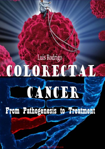 Colorectal Cancer - From Pathogenesis to Treatment.